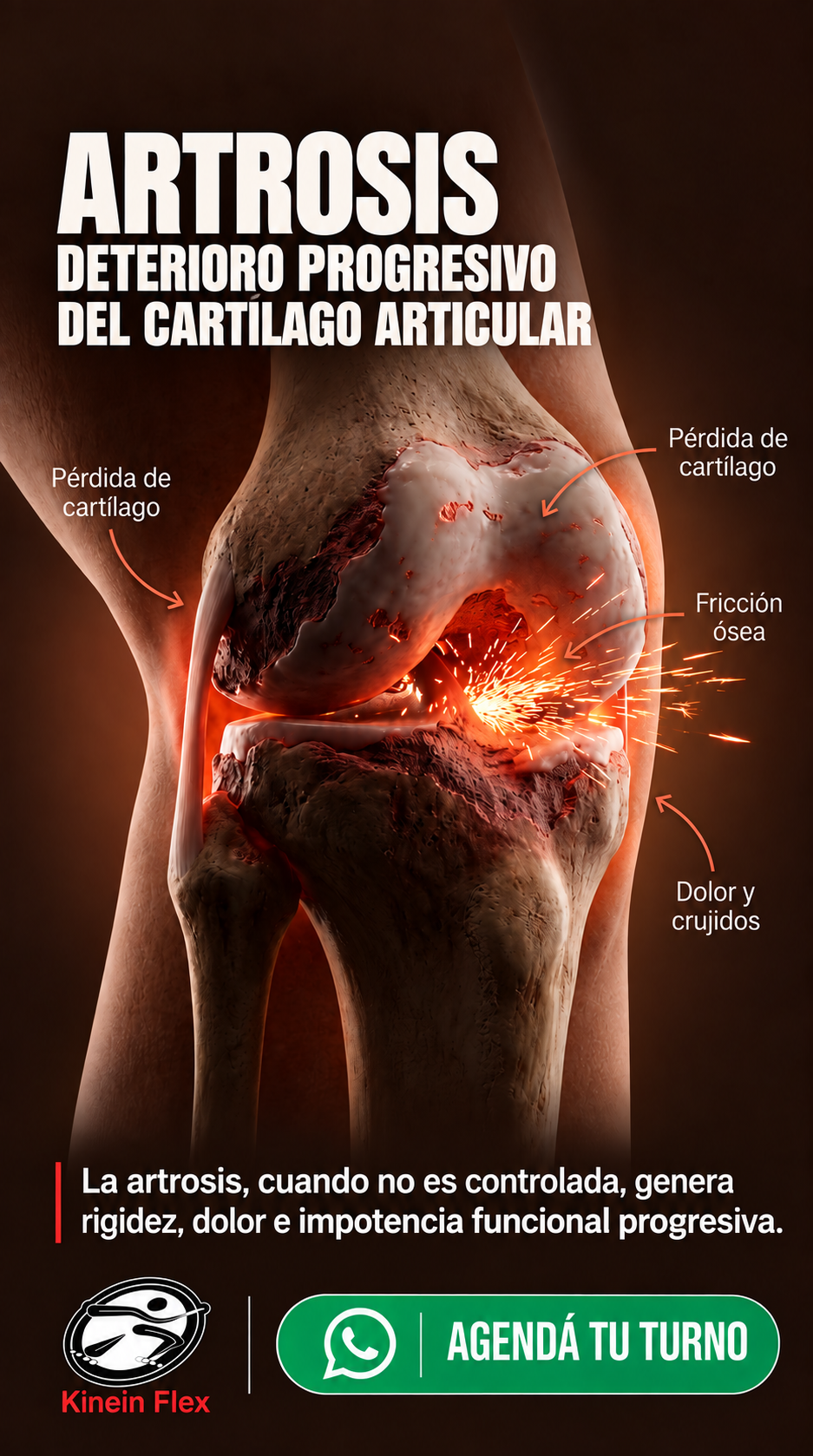 Publicación de Kinein Flex sobre artrosis de rodilla y deterioro progresivo del cartílago articular